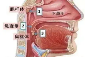 娃娃变丑咋回事图片