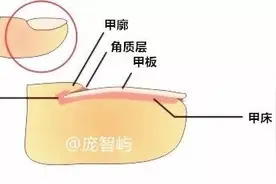 营养不良？疾病预兆？指甲上的竖纹与你的健康有关吗？图片