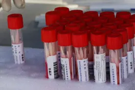 核酸结果互认落地 还需剔除过度防疫根源图片