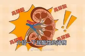 高尿酸血症什么时间需要开始治疗？图片