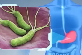 详细说“胃痛”！各种原因引起的胃痛帮你列全图片