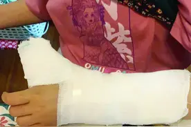 15岁女孩玩密室逃脱手掌骨折图片