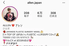 日本软饭男为变美拔16颗牙？美的代价也太大了图片