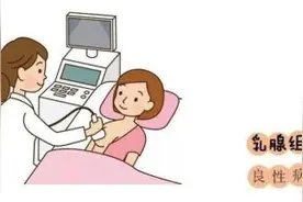 良性乳腺疾病，你了解多少图片