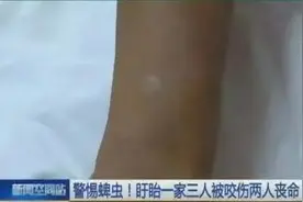 被蚂蚁咬到差点没命？这份毒虫咬伤急救手册用得着图片