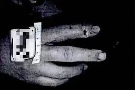 男子深夜敲开前女友家门，咬伤其现男友图片