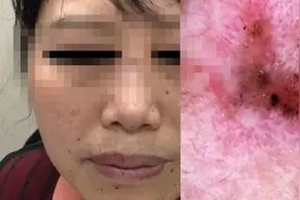 女子陪闺蜜看病，结果自己查出癌症！医生：我一眼就看出来了图片