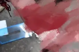 西安一男子被高楼坠落手机贴膜壳砸中，伸手一摸头满是鲜血：不要赔偿，只要道歉图片