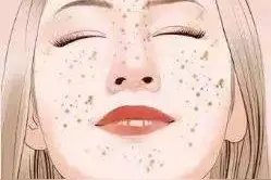 济南海峡整形分享：晒斑要怎么祛除？图片