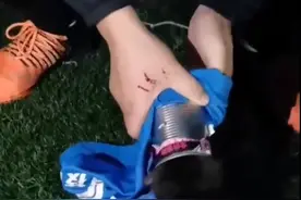 流浪猫头被卡在罐头里，武汉男子热心救助被抓伤花费近4000元打疫苗：不后悔，希望其他人一定做好防护图片