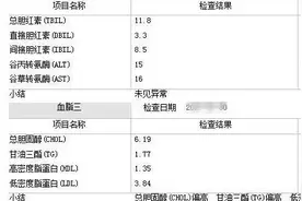 体检报告中的这些符号，你都看懂了吗？图片