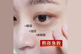 黑眼圈不都是熬夜造成的图片