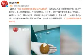 警惕！男子排尿疼痛没在意，医生取出结石大如鹅蛋图片