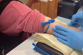 仨月苦练上万次学成“飞针采血”当事人：快了能减少害怕和疼痛 广受女生和老人欢迎图片