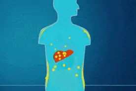 明明不胖，为什么会得脂肪肝？脂肪肝还能逆转图片