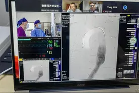 主动脉夹层手术体外开“大窗”在主动脉弓部精确放“支架”图片