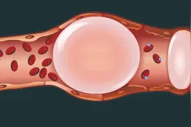 注射器中的气泡注入人体内会致死吗？图片