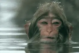 头上抠下来的小颗粒，到底是啥图片