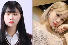 日本丑男为变美怒砸千万断骨增高、疯狂整容，结果反转惊为天人图片