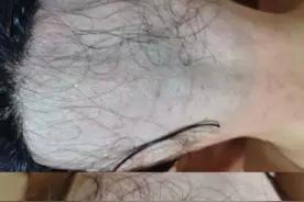 被“剃头”的女性们：遭骗剃光后脑勺，维权牵出一条迎合怪癖产业链图片