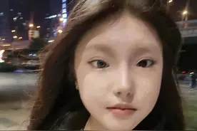 18岁女孩左眼天生蓝瞳，当事人回应图片