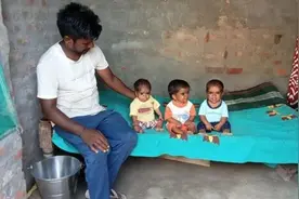 印度三兄弟患罕见病 永远都长不高图片