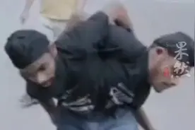 连体双胞胎兄弟上班只领一份工资，想在25岁后娶同一个人图片