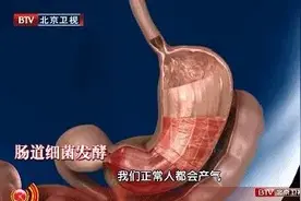 肚子不饿却总是“咕咕叫”？可能是身体在报警！出现这几种情况就要当心了图片
