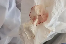 阳后大口吐血！男子急诊一个细节让医生警惕：出现这几个症状快就医图片