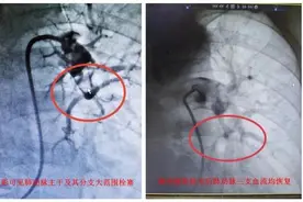 阳性1个月后，风险增加33倍！出现这两个症状要警惕图片