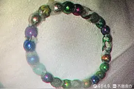 男孩误吞24颗磁力珠 滨医附院医师小心“打捞”将异物一网打尽图片