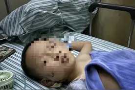 江西7岁男童遭邻居炮仗炸伤手臂截肢，当地警方：已展开侦查图片