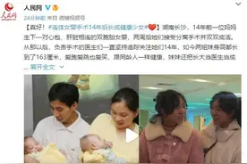 真好！连体女婴手术14年后长成健康少女图片