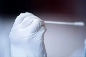 新冠病毒抗体检测来了图片