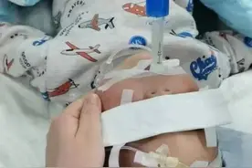 惊险！嵌入小朋友气管半年之久的瓜子皮被取出了……图片