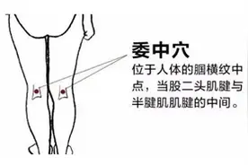 记住这一招，急性腰扭伤快速缓解！图片