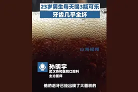 00后男生长期可乐当水喝牙全坏，日喝3瓶几乎不喝水，医生：后牙基本全部被可乐腐蚀图片