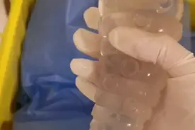 男子基于好奇将20cm长异物塞入直肠，堵死了关键“出口”