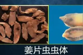 吓人！27岁女子体内揪出2条活虫，竟是因为这东西！很多深圳人爱吃图片