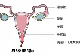 14岁还不来月经，小心这些罕见病图片