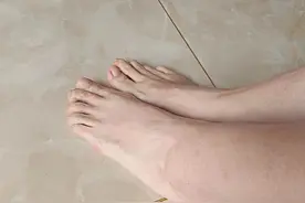 穿43码鞋的马凡综合征女孩：母亲哥哥相继离世，带仅剩的2000元寻医，2次心脏手术后恢复正常图片