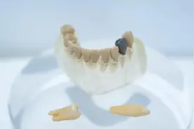 “湾”转“黑科技”｜3D打印你的牙图片