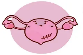 【健康科普】有关“子宫肌瘤”的那些事儿图片