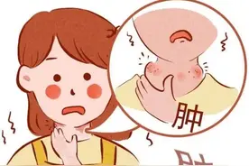 查出甲状腺结节该怎么办？是否需要治疗？图片