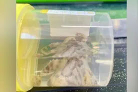 澳大利亚一名女子游泳时被蓝环章鱼咬伤图片