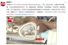 靠闻就能诊断疾病？身上有这6种气味，小心是疾病信号！图片