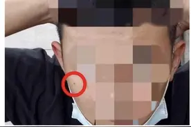 台湾通缉犯遇警察盘查，谎报双胞胎弟弟身份，因1颗痣露馅图片