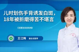 微故事：儿时划伤手背诱发白癜风，18年来苦不堪言图片