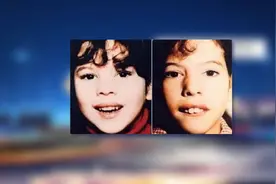 预告丨孩子越长越丑 警惕腺样体肥大图片