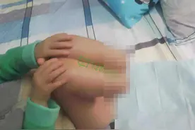 生母疑虐待5岁男童致其双腿截肢，父亲：之前只觉得她脾气急躁图片